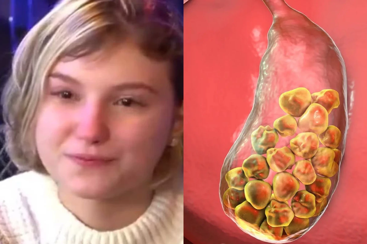 Hipermagnesemia: o que é, quais os sintomas e riscos da condição grave que levou Isabel Veloso a ser intubada