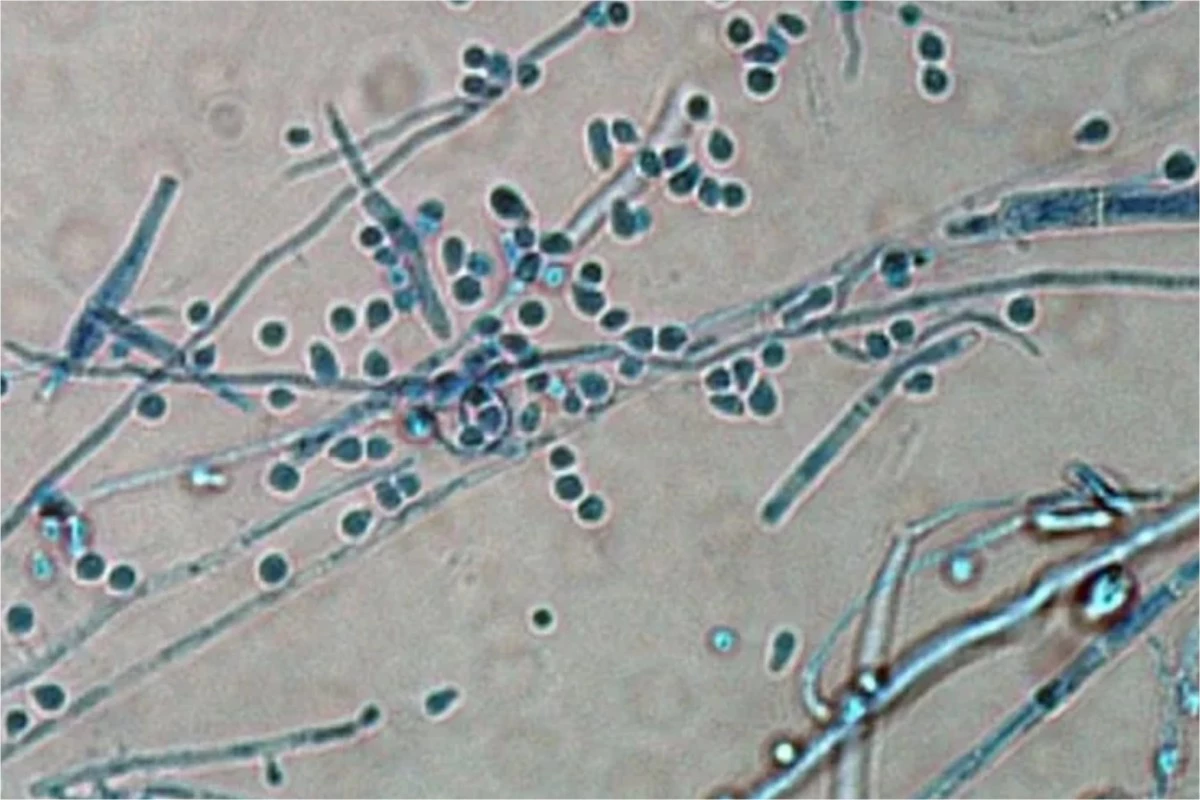 Superfungo já chegou ao Brasil após se espalhar por vários países