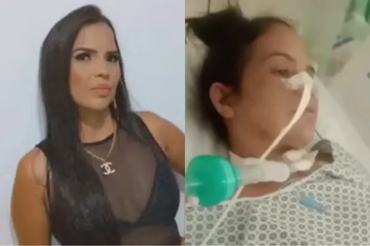 O que é Guillain-Barré, condição que afetou mulher de 42 anos após uso de caneta emagrecedora