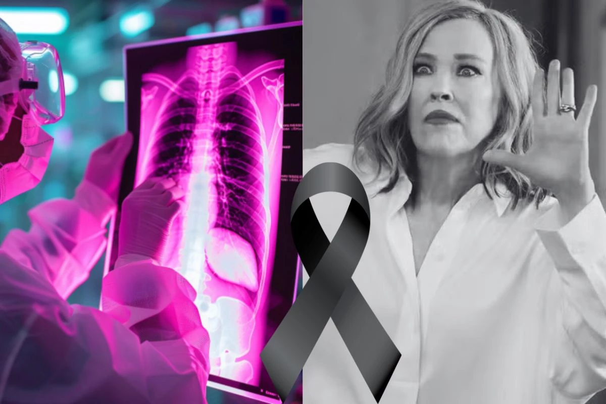 Principais sinais da embolia pulmonar: site aponta motivo da morte da atriz Catherine O’Hara