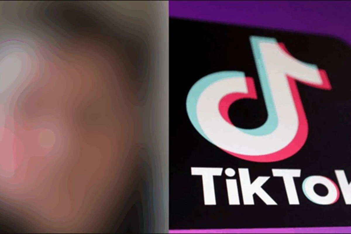 Desafio do TikTok termina em acidente grave e deixa menino com rosto deformado;
